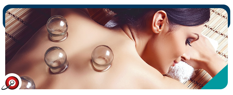 Cupping Therapy Lanham, College Park & Berwyn Heights, MD Cupping Therapy Lanham, College Park & Berwyn Heights, MD