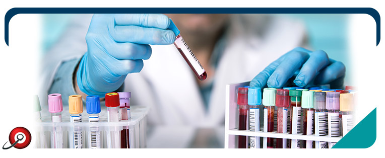 Chlamydia Testing Questions and Answers Chlamydia Testing Questions and Answers