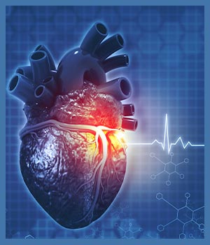 Cardiology Treatment at Express Healthcare in College Park MD