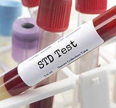 STD Testing at Express Healthcare in College Park MD, New Carrollton MD, Falls Church VA and Vienna, VA