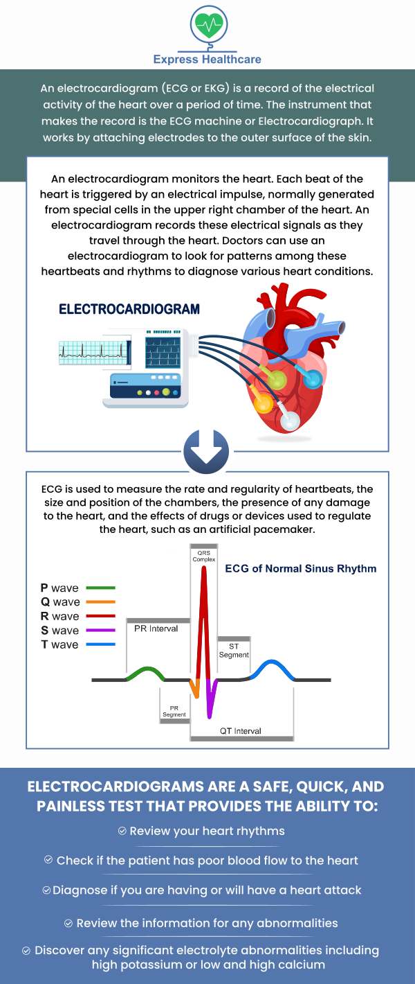 An EKG is a non-invasive, painless test that our Dr. Joahn Hakim can use to monitor the rhythm of your heart and assess your heart. The information from your EKG will assist your healthcare professional in determining which treatment is best for you. You may require an EKG if you are having symptoms such as chest pain, shortness of breath, dizziness, fainting, or a sensation of your heart racing, fluttering, thumping, or hammering in your chest (palpitations). EKGs are available at Express Healthcare, LLC. For more information, contact us or schedule an appointment online. We are conveniently located at 4701 Melbourne Place College Park, MD 20740.